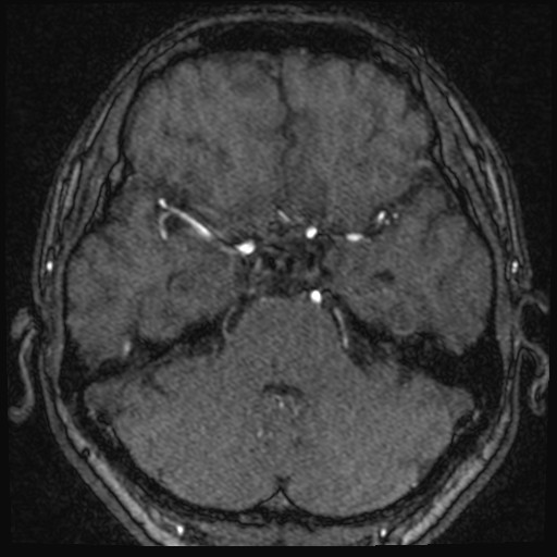 Click on the Serie image to view the images of VILLANUEVA, WILLIAM A.